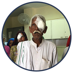 Cataract Surgeries